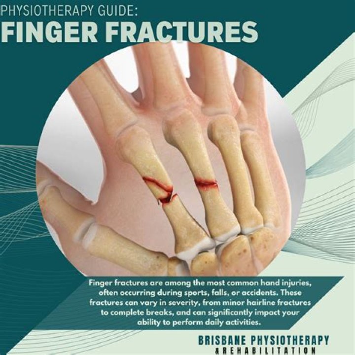 Brodie Moss Finger Bite: Unpacking the Viral Moment and What It Means